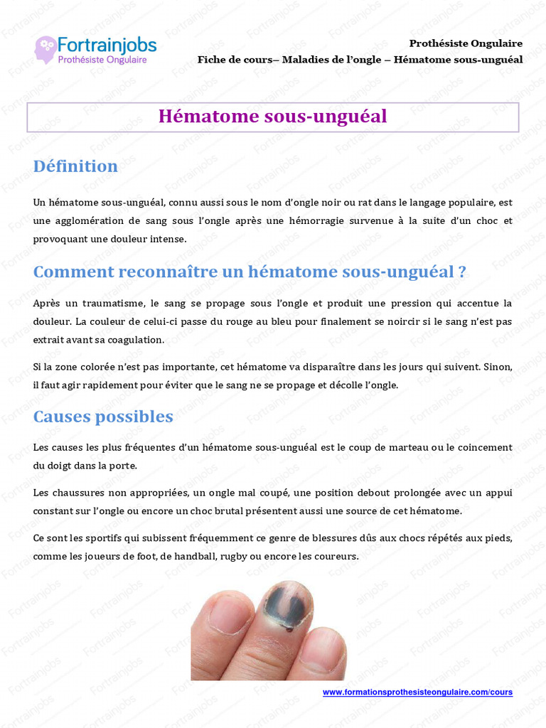 Hématome sousunguéal traitement et durée PDF Médecine clinique — free download