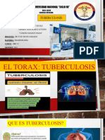 Tuberculosis Oficiual