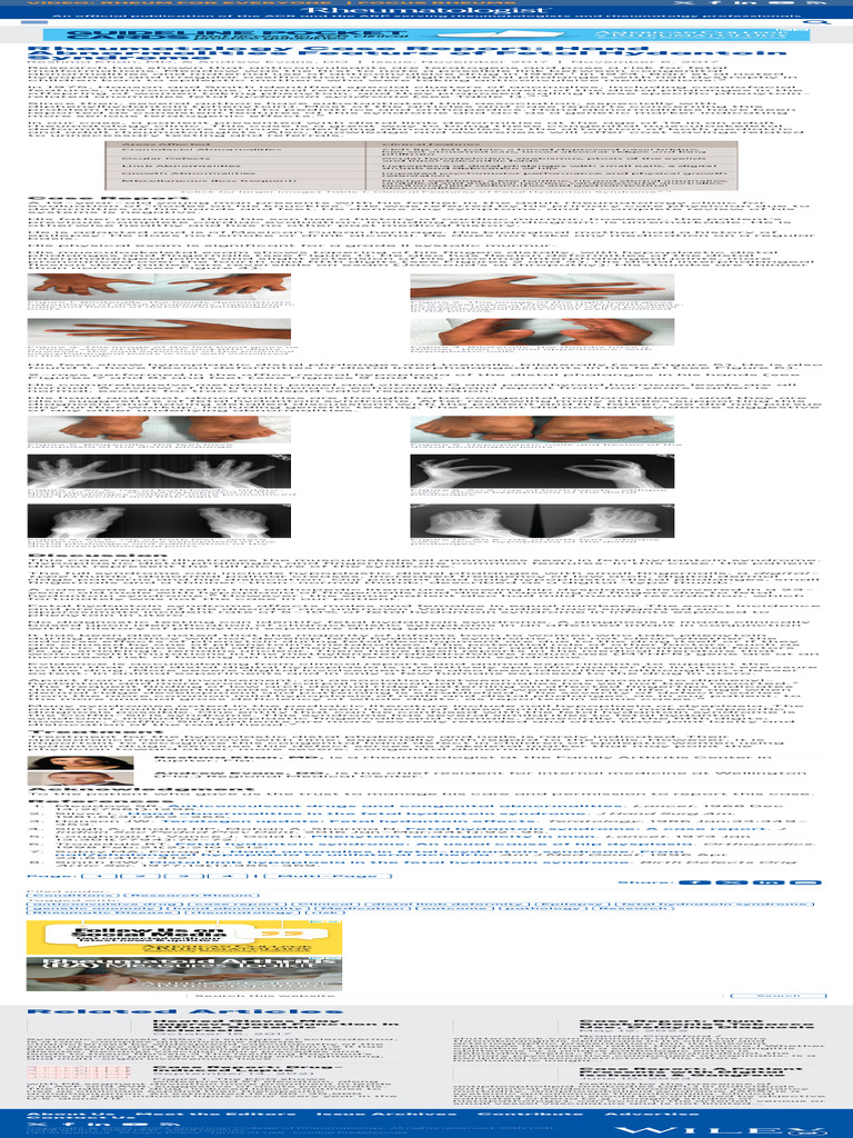 Rheumatology Case Report Hand Abnormalities Feat… PDF Medical