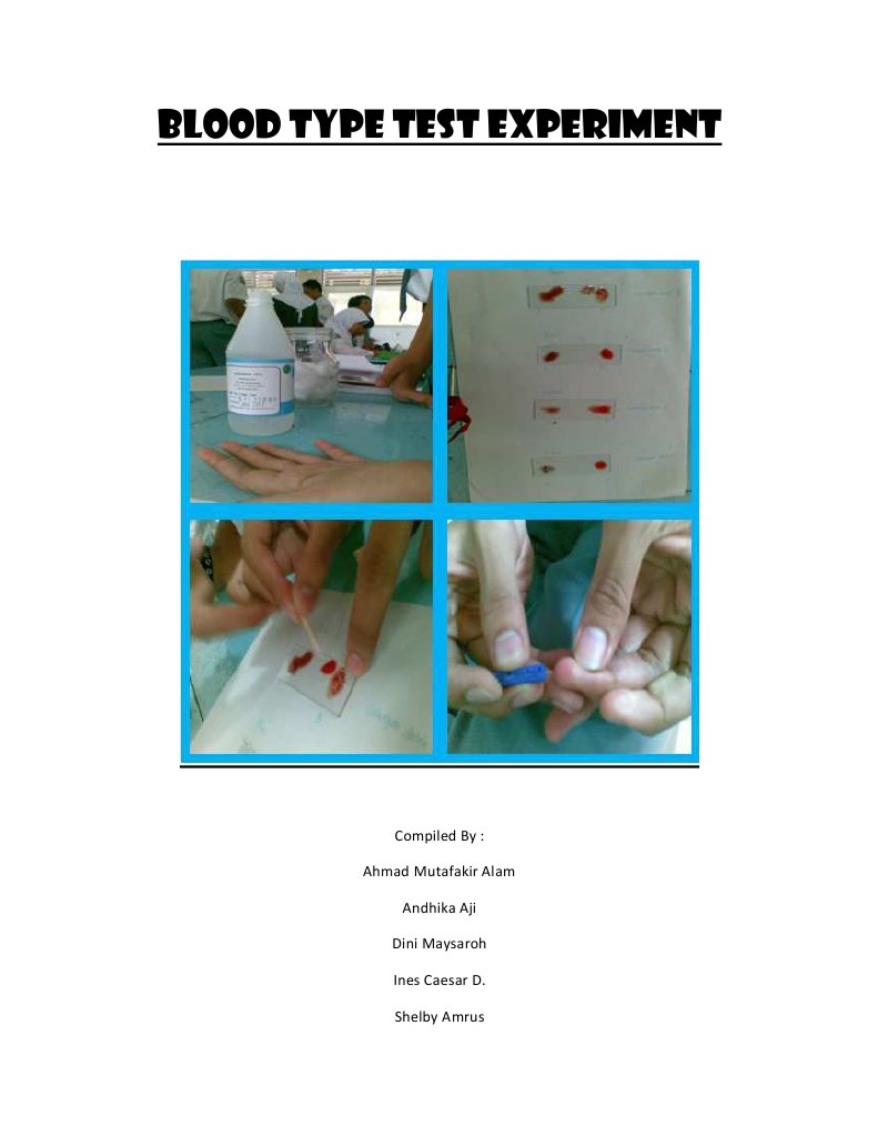 Blood Type Test Experiment | PDF | Blood Type | Pathology