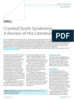 Cracked Tooth Syndrome: A Review of The Literature