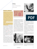 Ancreatitis Crónica: Definición y Clasificación