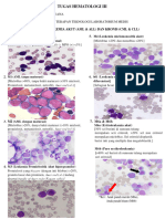 Tugas Gambaran Sel Darah Pendrita Leukemia