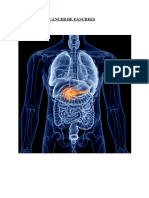 Mini TDR - Càncer de Pancrees