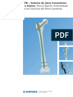 De Las Fracturas Del Fémur Proximal.: TFN - Sistema de Clavo Trocantéreo de Titanio. para La Fijación Intramedular