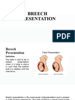 Breech Presentation