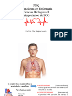 ECG