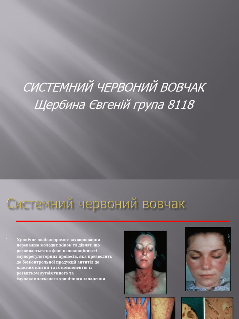 СЧВ | PDF