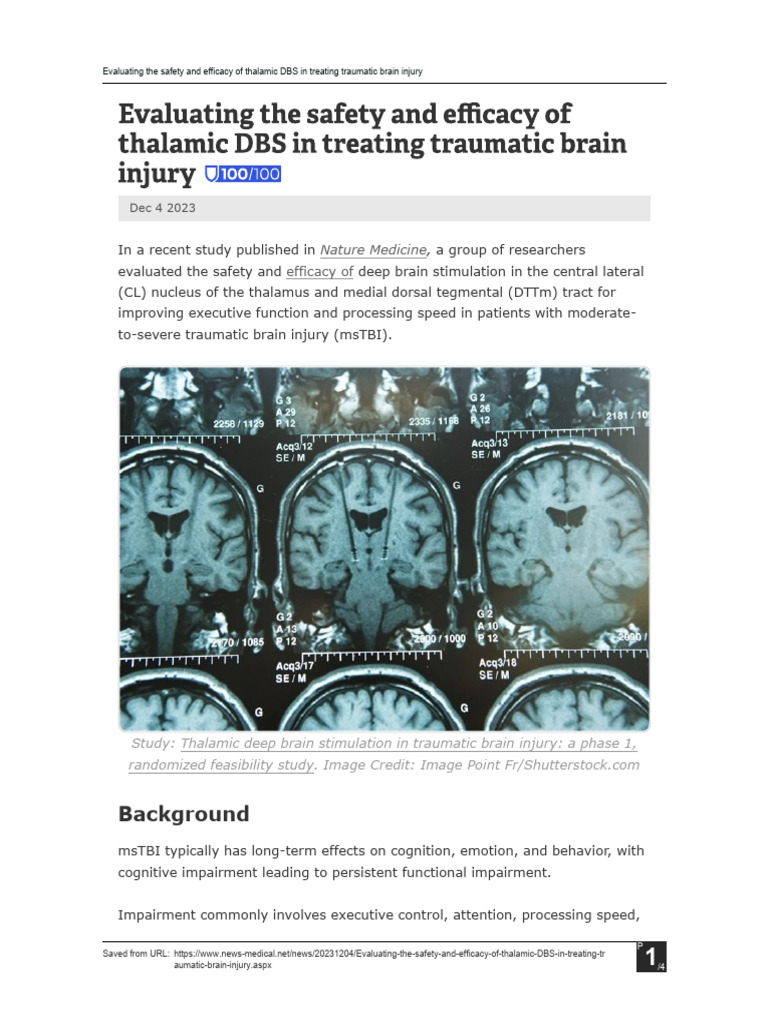 Evaluating Safety and Efficacy of Thalamic DBS in Treating TBI | PDF