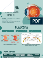 GLAUCOMA - Pilocarpina Vs Timolol