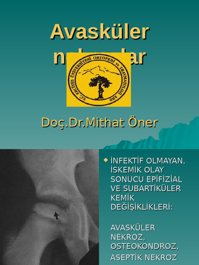 Avasküler nekrozlar M ÖNER | PDF