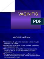 21. Vaginitis