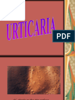 Urticaria