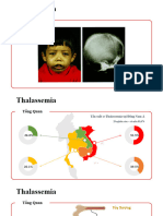 Thalassemia