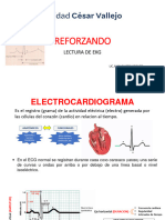 Reforzando Ekg