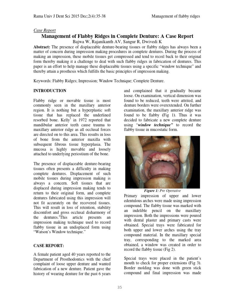 Management_of_Flabby_Ridges_in_Complete | PDF | Dentures | Dental Implant