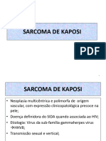 SARCOMA DE KAPOSI-Aula UEM 2sem20