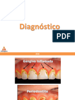 Classificação Das Gengivites