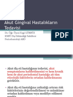 Akut Gingival Hastalıkların Tedavisi