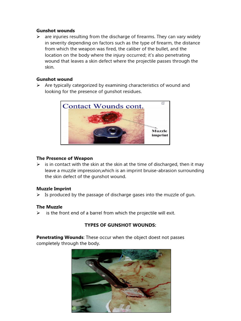 Understanding Gunshot Wounds and Types PDF Gun Barrel Flight