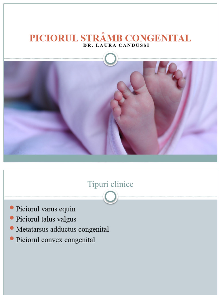 Piciorul Strâmb Congenital | PDF