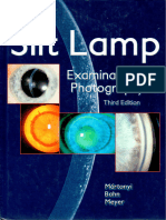 Slit Lamp Examination and Photography