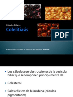 Colecistitis y Colelitiasis