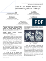 Parastomal Hernia