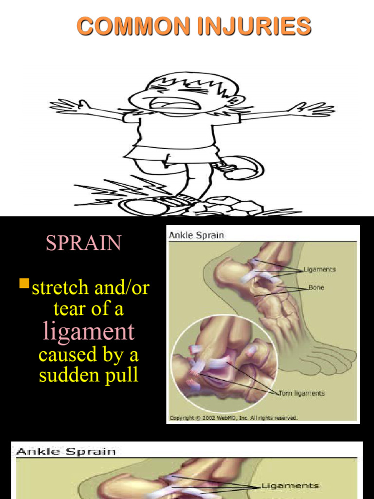 1q.pe Sprain Strain Fracture Dislocate | PDF | Medical Specialties ...