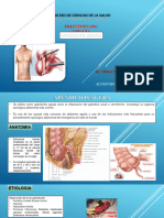 Apendicitis Aguda