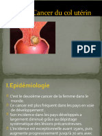 Cancer Du Col Utérin