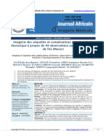 Imagerie Des Séquelles Et Complications de Tuberculose Thoracique À Propos de 40 Observations Au CHU HASSAN II de Fès (Maroc)