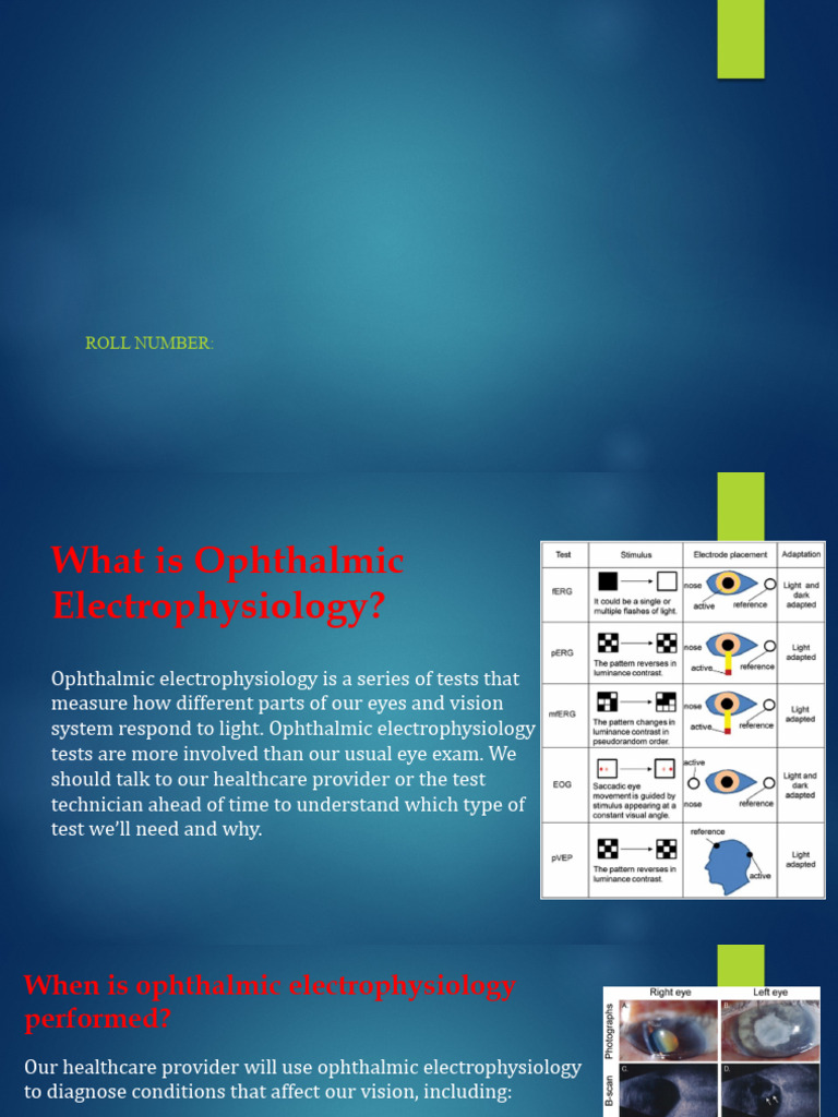 Keya Chakrabarty Presentation | PDF | Retina | Human Eye