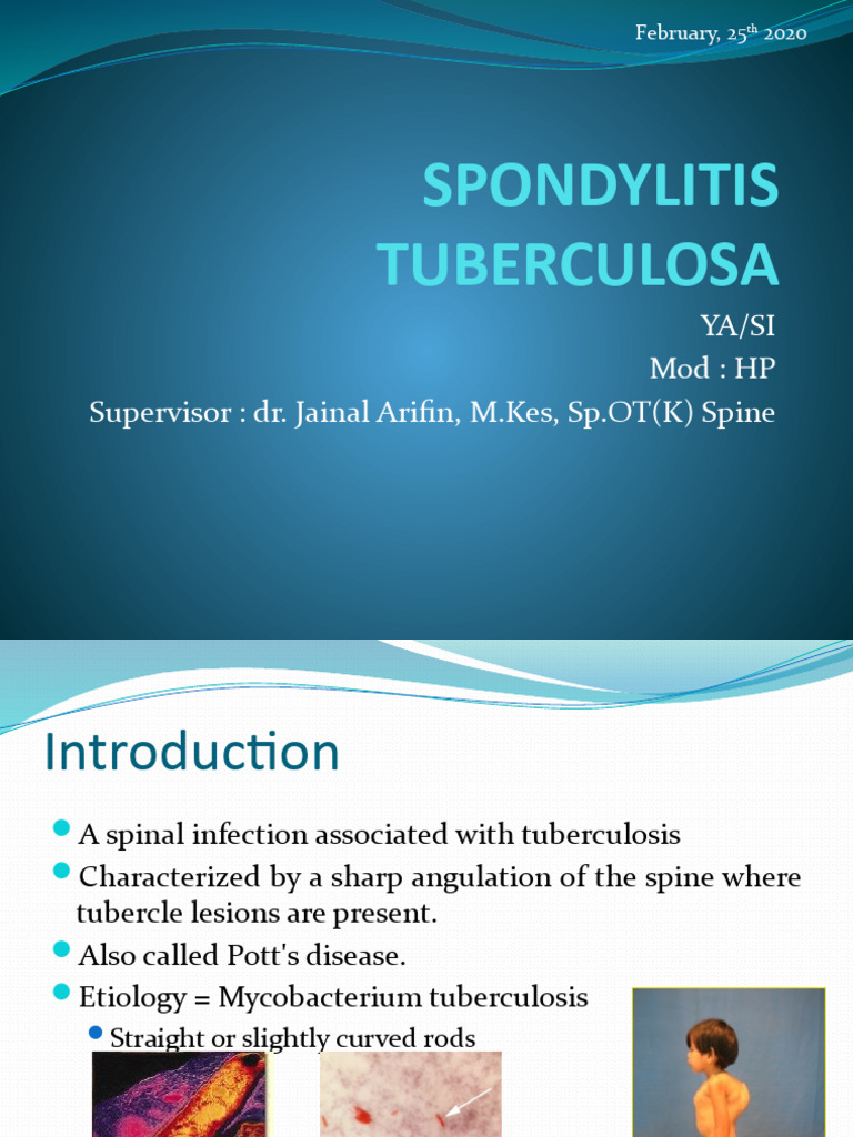 Spondylitis TB | Download Free PDF | Vertebral Column | Tuberculosis
