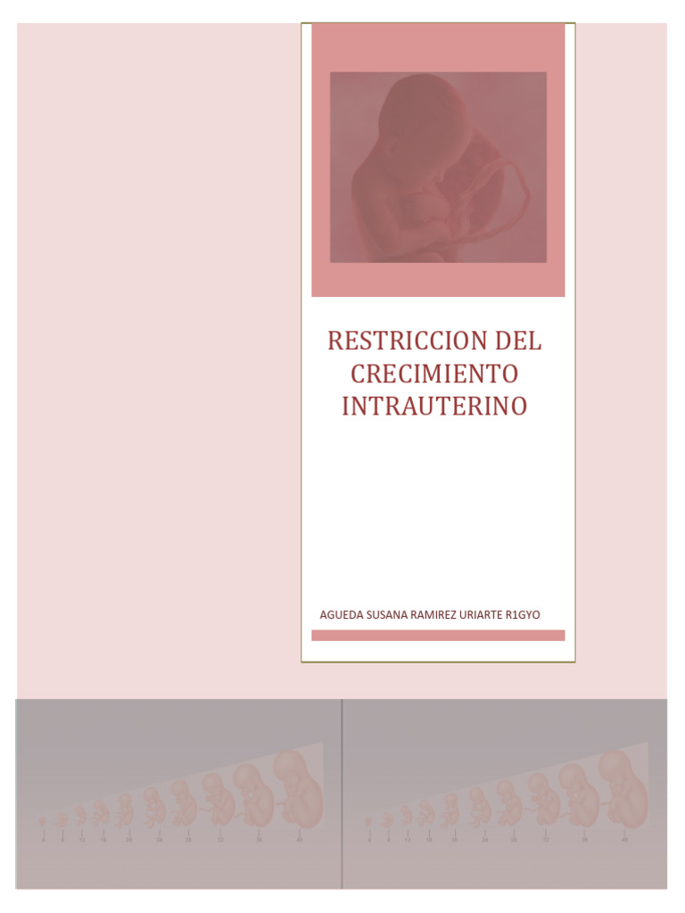 Diagnóstico y Tratamiento de RCIU | PDF | Feto | El embarazo