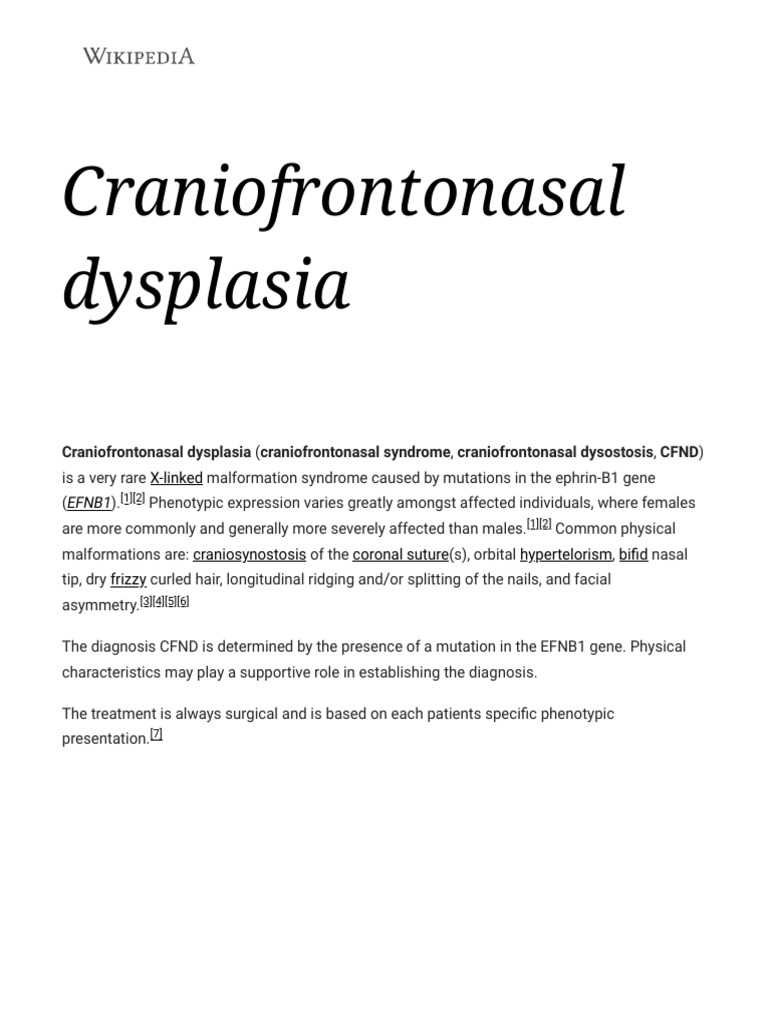 Craniofrontonasal Dysplasia Wikipedia PDF Human Diseases And