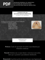 Planejamento De Protese Parcial Removivel
