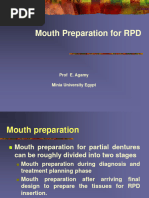 (1)Mouth Preparation for Removable Partial Denture March 2020 Ppt