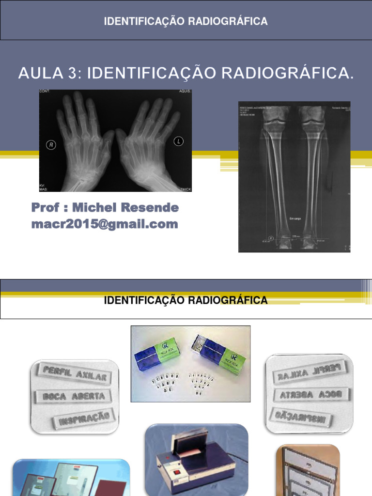Identificação Radiográfica Correta | PDF | Radiologia | Radiografia