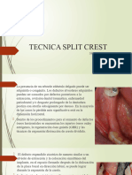 TECNICA SPLIT CREST