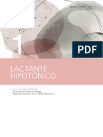 Lactante Hipotonico