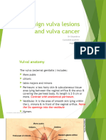 Benign Vulva Lesions