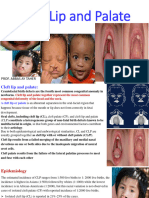 CLEFT LIP AND PALATE       ===       FIFTH   2023