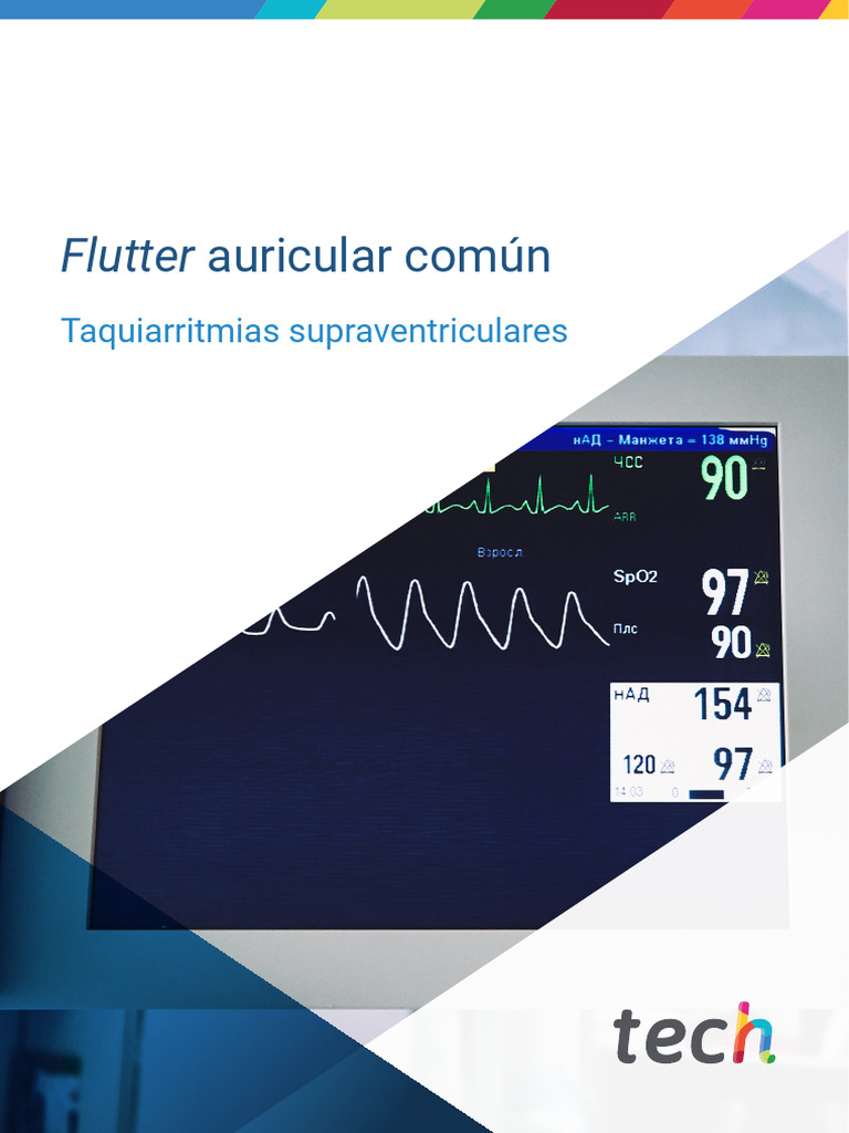 Flutter Auricular Común M3 T8 | PDF | Electrofisiología cardíaca ...