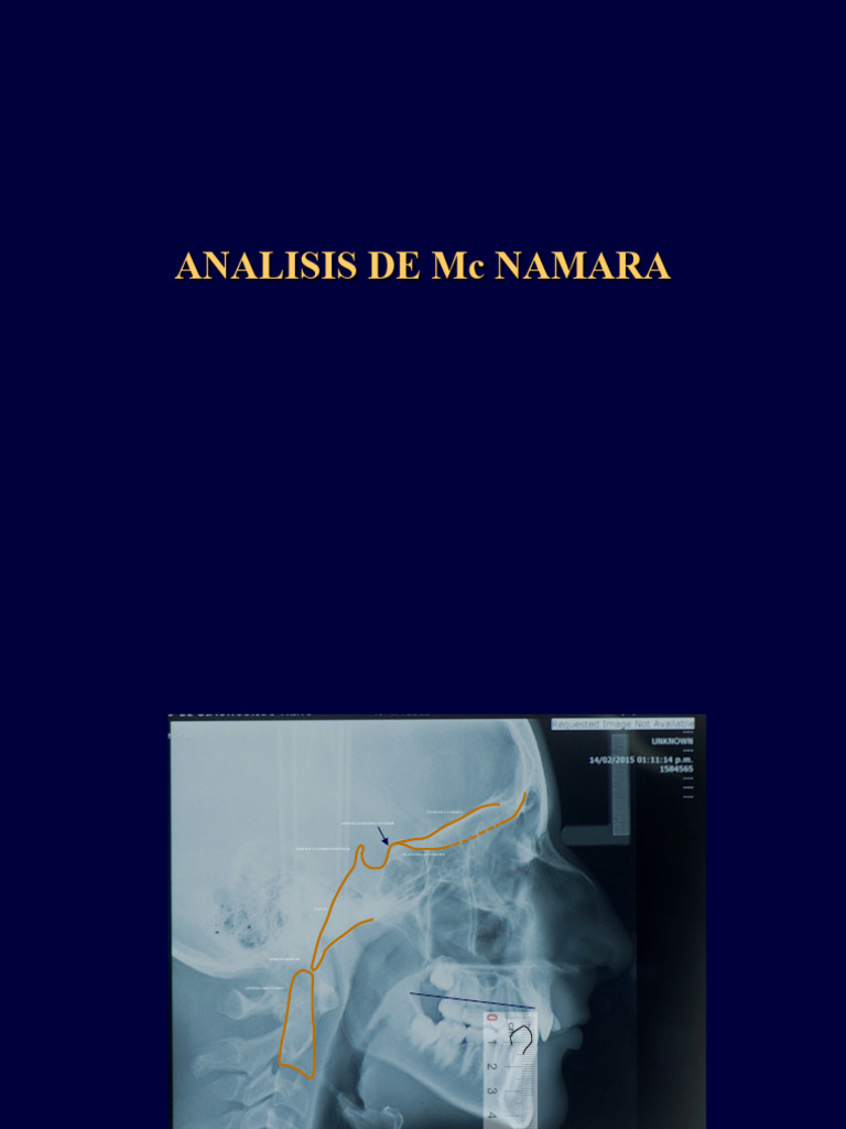 Cefalograma de Mcnamara | PDF | Cabeza y cuello humanos | Cráneo