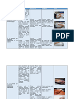 Tipos de Prensiones Ba