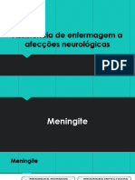 Meningite