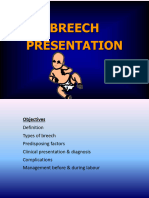 Breech Presentation