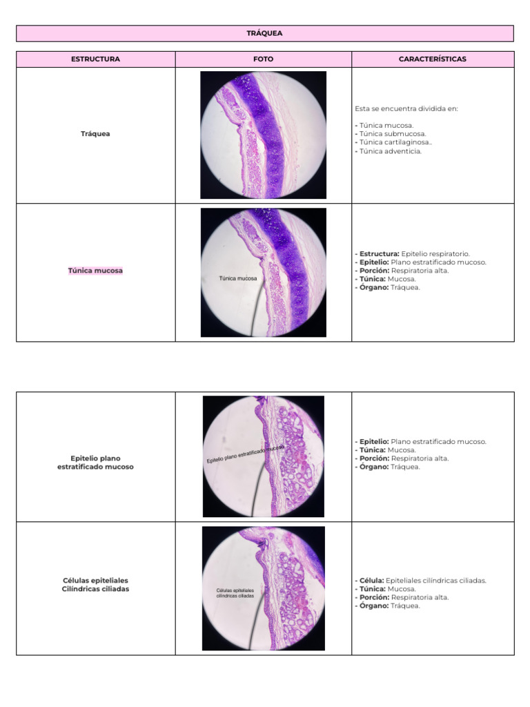 Epitelio Traqueal Pdf : Histologia Del Sistema Respiratorio – QTIRHX