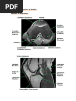 Anatomía y RM de Rodilla Normal | PDF | Rodilla | Extremidades (anatomía)